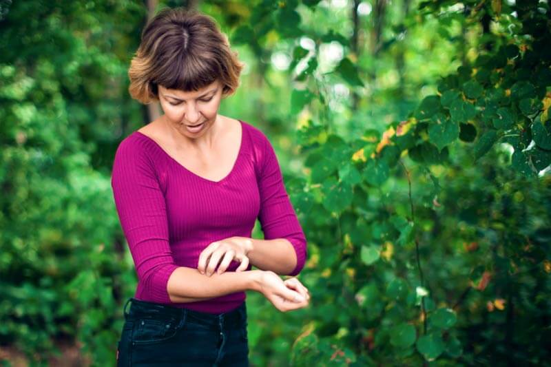 Women checking her arm for bee sting symptoms